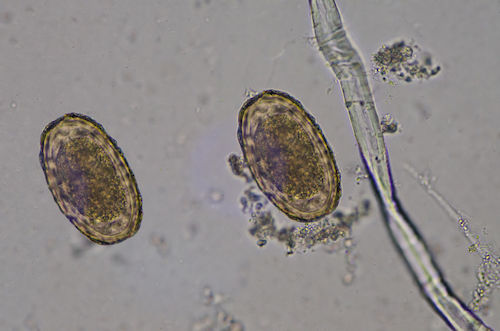 parasite cleansing information