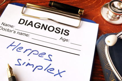 Herbs Essential Oils for Genital Herpes Infection